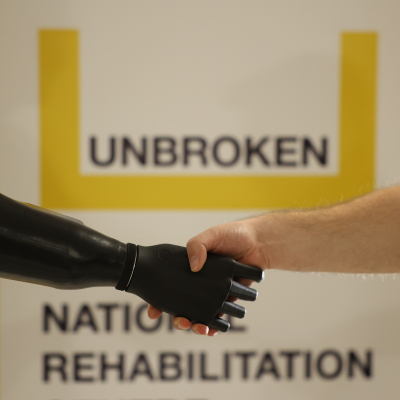 MORE THAN UAH 30 MILLION COLLECTED ON PROSTHETICS WITHIN "FISHKOGRAY" PROJECT