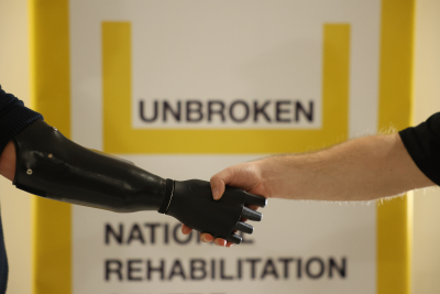 MORE THAN UAH 30 MILLION COLLECTED ON PROSTHETICS WITHIN "FISHKOGRAY" PROJECT